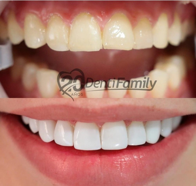 Slider image (7) DENTIFAMILY